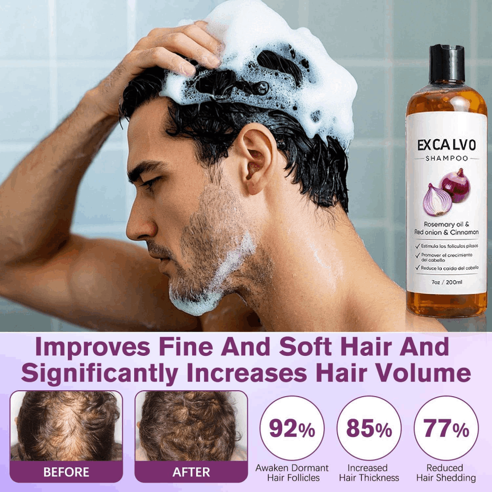 Шампунь против выпадения волос – обзор и цена Rosemary Hair Oil
