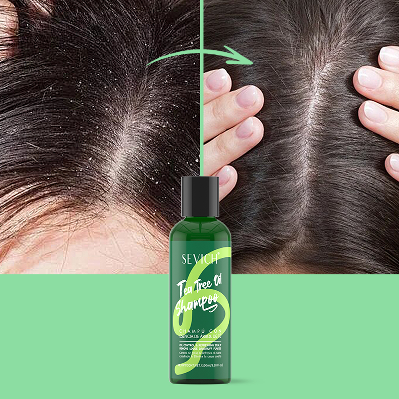 Шампунь с эссенцией чайного де – обзор и цена Hair Care Set