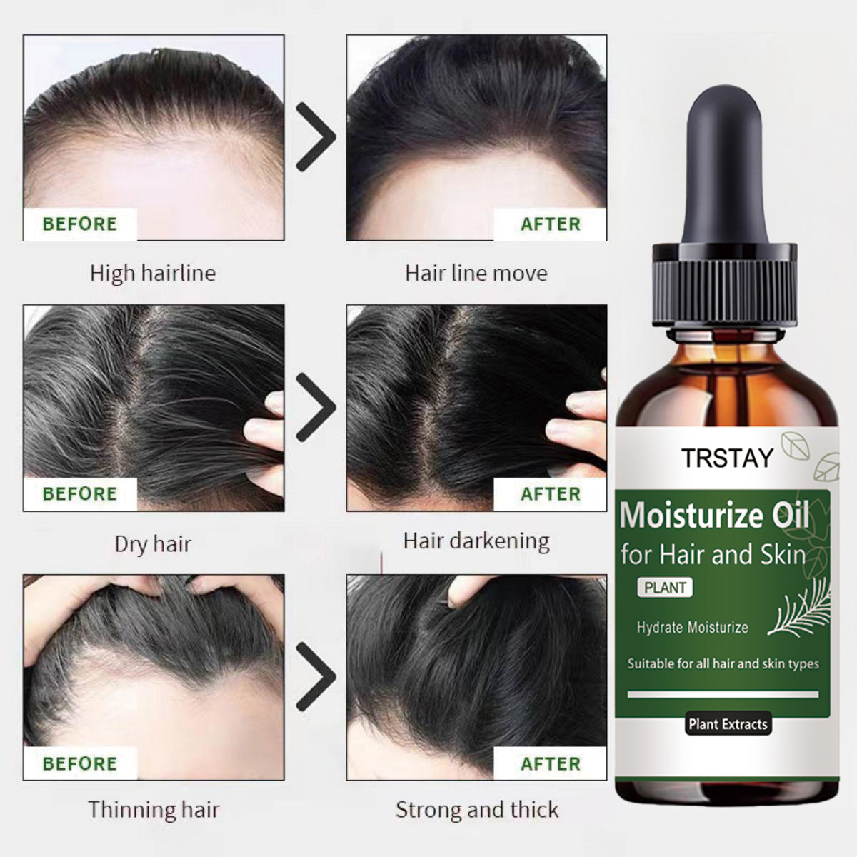 TRSTAY Эфирное масло розмарина – обзор и цена Rosemary Hair Oil